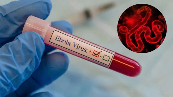 TP HCM tăng cường kiểm soát người nhập cảnh để phòng ngừa Ebola